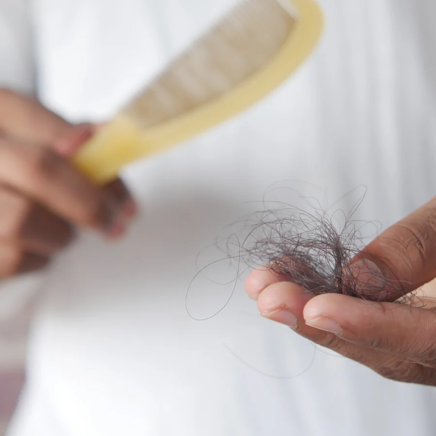 Hair shedding from a scalp allergic reaction